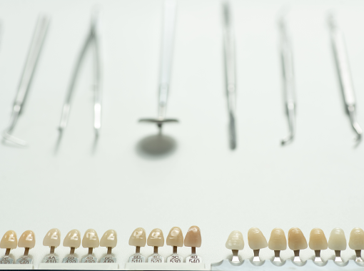 Primary Dental Careのダイレクトボンディング治療の特徴
